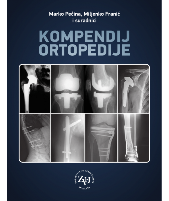 Kompendij ortopedije