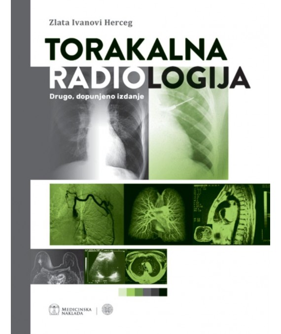 Torakalna radiologija